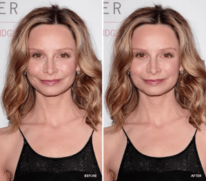 19873-defy-aging-with-fat-calista-flockhart.png.660x0_q80_crop-scale_upscale